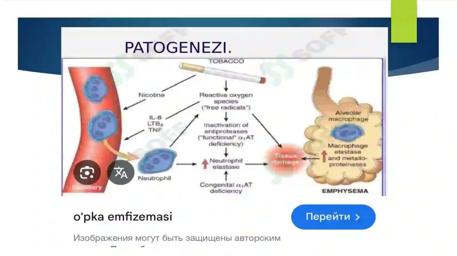 O'pkaemfizemasi 4