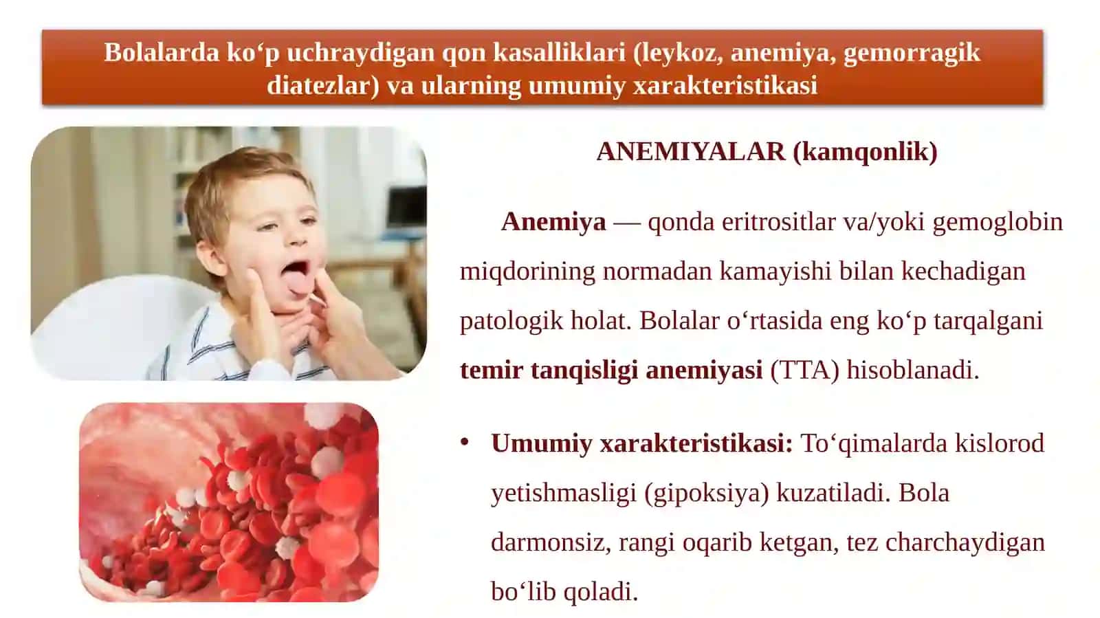 BOLALARDA OG‘IZ BO‘SHLIG‘I SHILLIQ QAVATIDA QON KASALLIKLARIDA SODIR BO‘LADIGAN O‘ZGARISHLAR, KLINIK BELGILARI, TASHXISI, DAVOSI.pptx 4