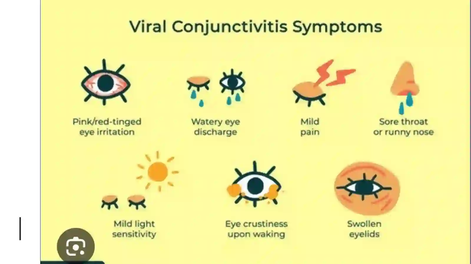 Virusli konyuktivitlar 4