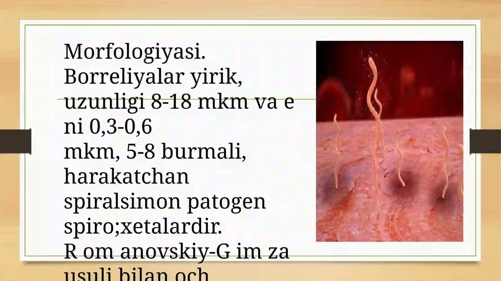 Borreliozlar morfologiyasi Borreliozlar morfologiyasi strukturasi Tarqalganligi keltirib chiqaruvchi kasalliklari mavzusida tayyorlagan 4