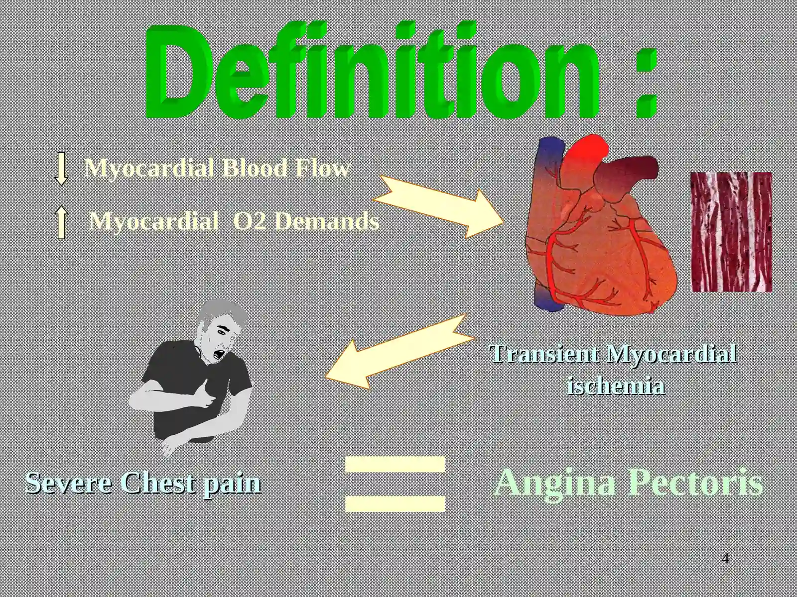 Angina Pectoris 4