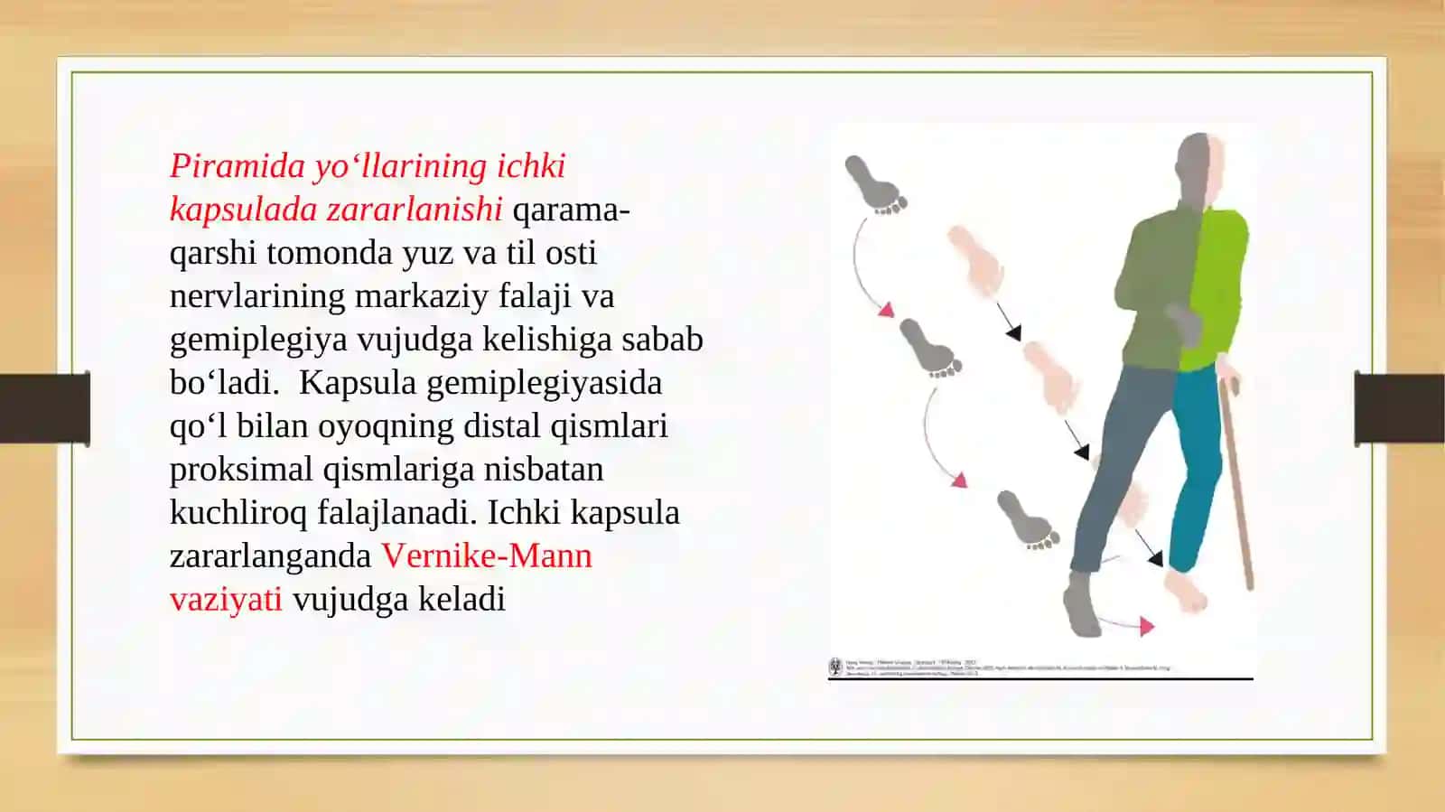 Harakat yo‘lining zararlanishi ni topik diagnostikasi 4