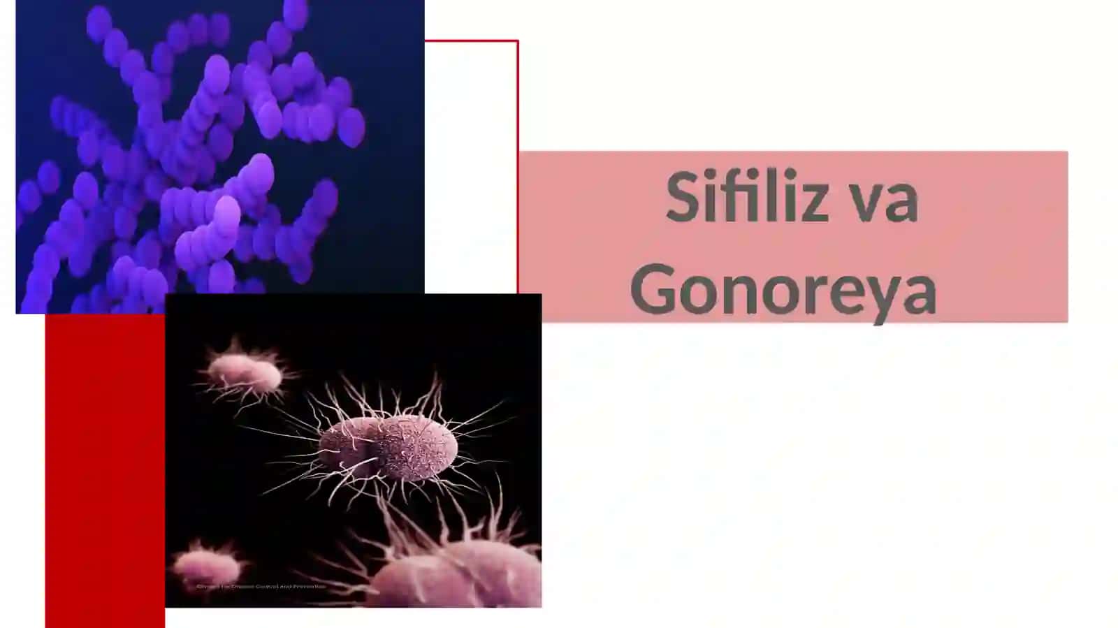 Sifiliz va Gonoreya 4