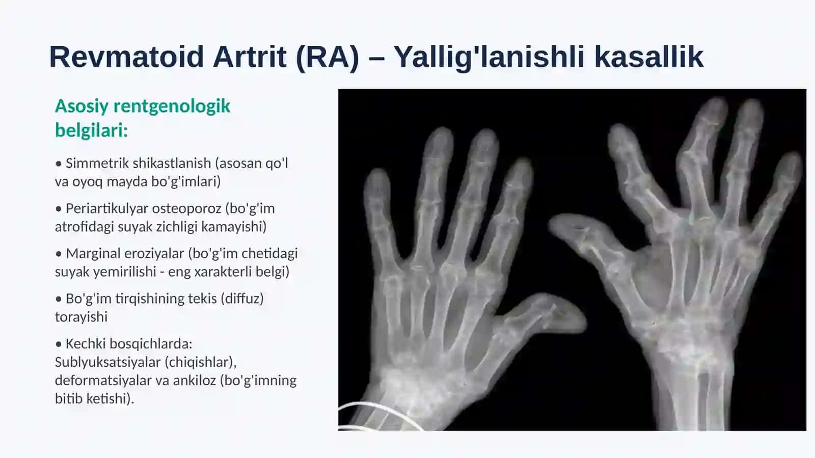 Radiologiya:Artritlar 4