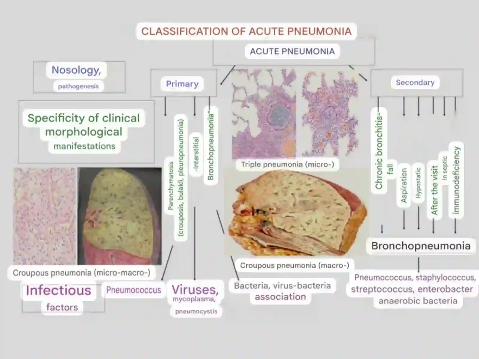 Lung diseases 4