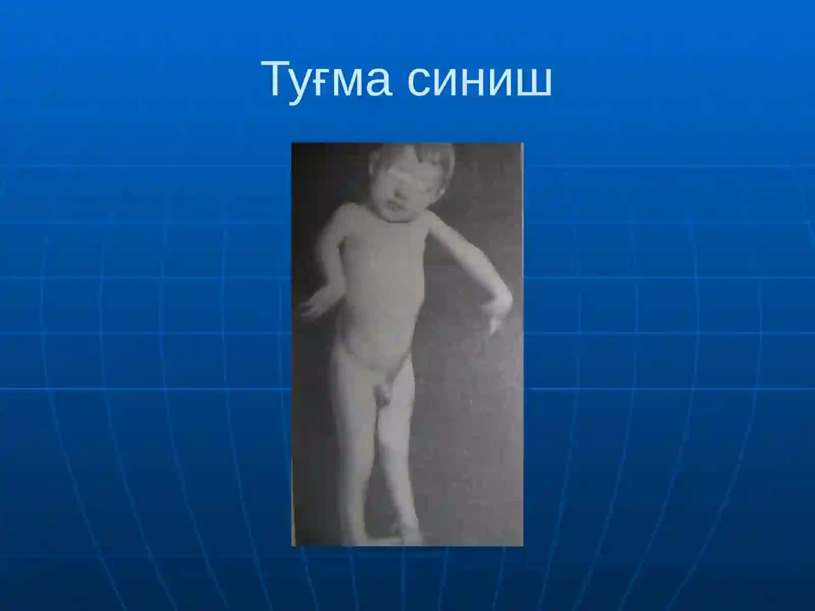Суякларнингсинишивачикиши 4