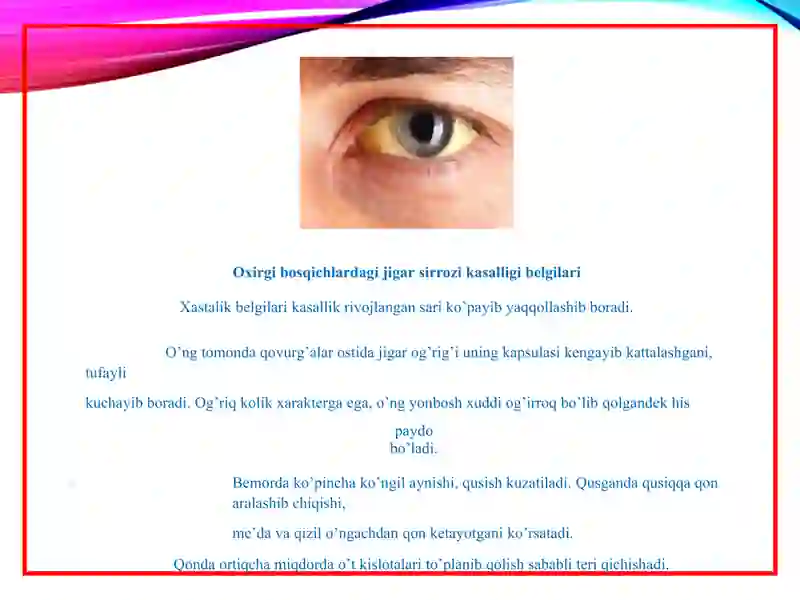 Surunkali gepatit Jigar sirrozi 4