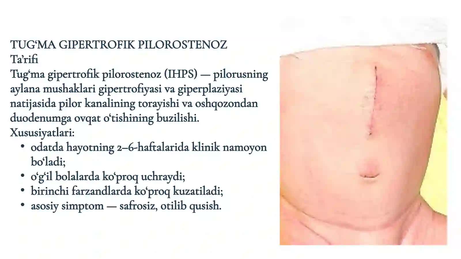 Bolalarda oshqozonning tug‘ma nuqsonlarida shoshilinch tibbiy yordam 4