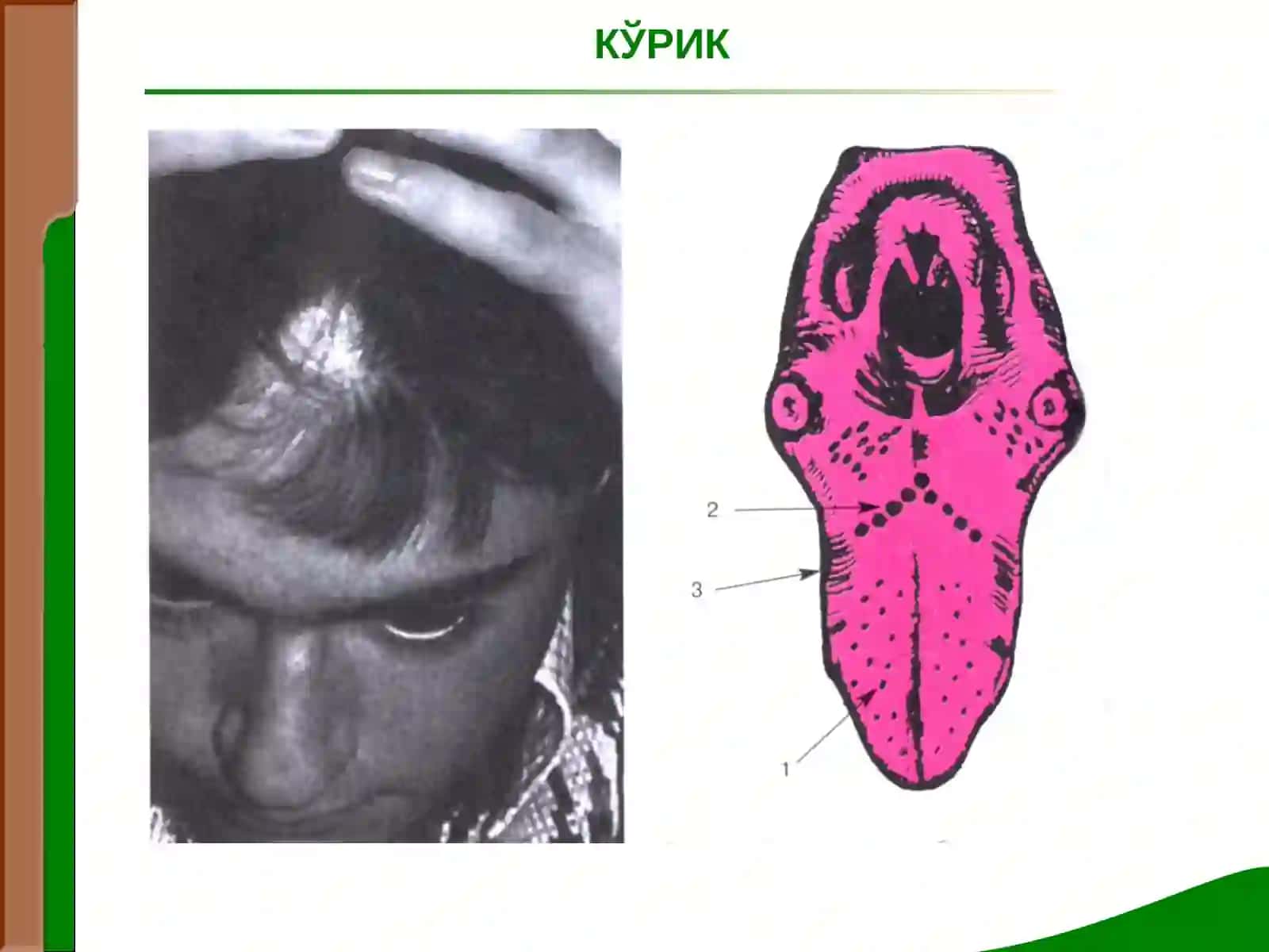 Маъруза № 12 Жигар ва ўт йуллари касалликалари билан касалланган беморларни текшириш 4