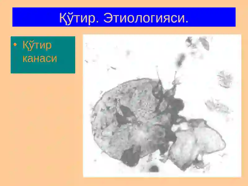 Терининг Паразитар Касалликлари 4