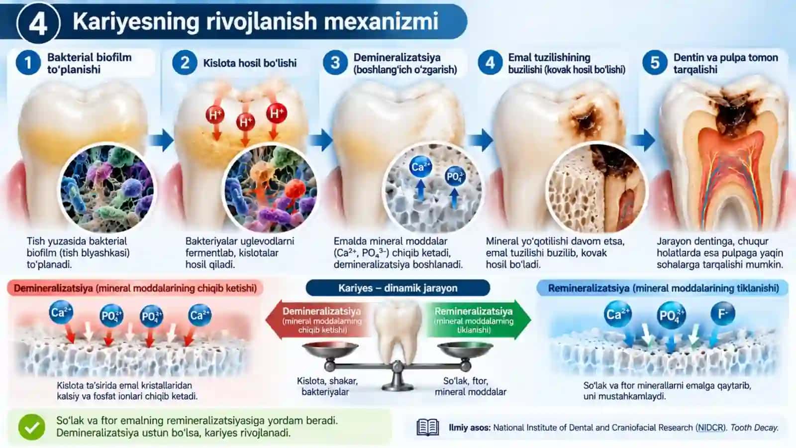 Kariyes va uning tasnifi — Professional tibbiy taqdimot 4