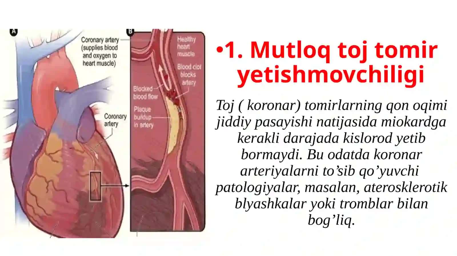 Mutloq vanisbiy tojtomir yetishmovchiligi 4