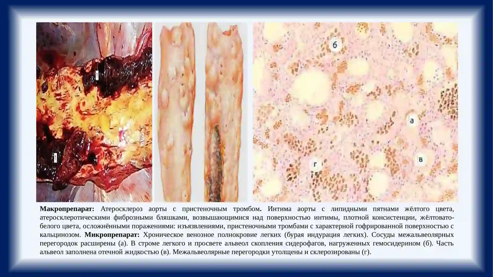 МАКРО И МИКРОПРЕПАРАТЫ 4