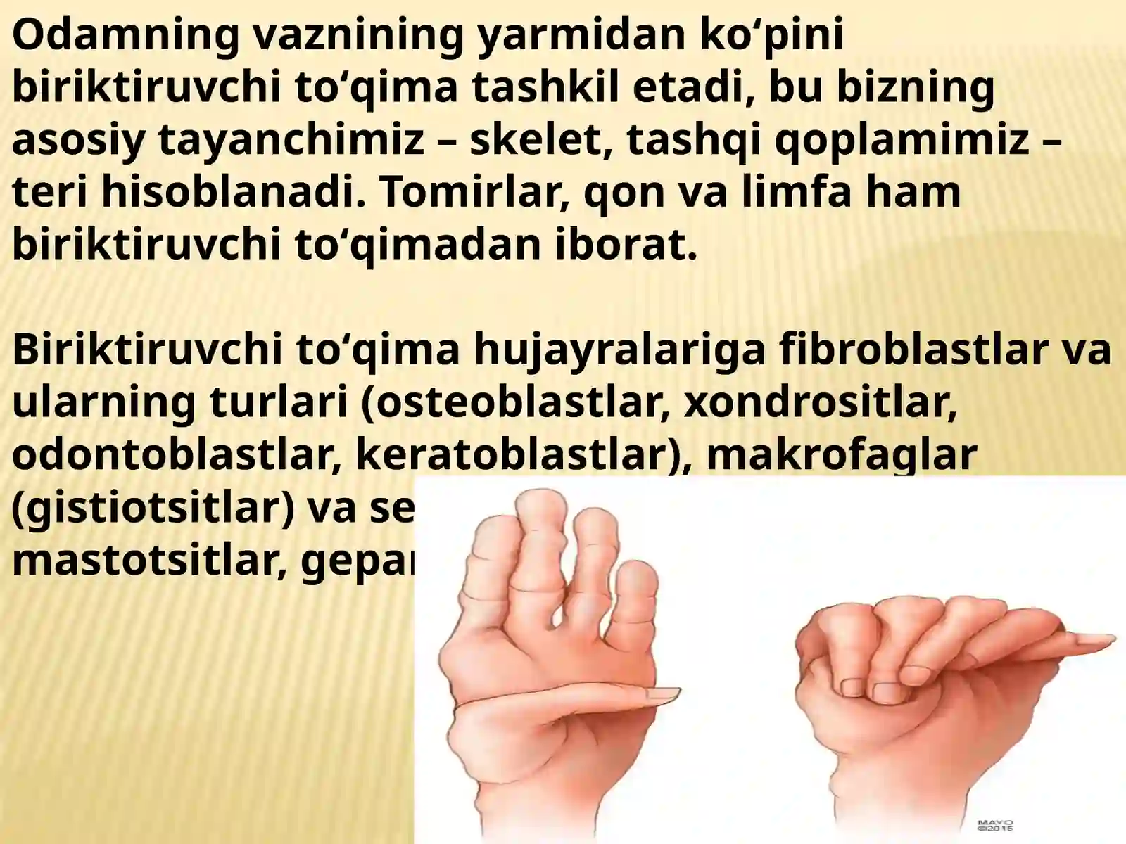 Marfan sindromi 4
