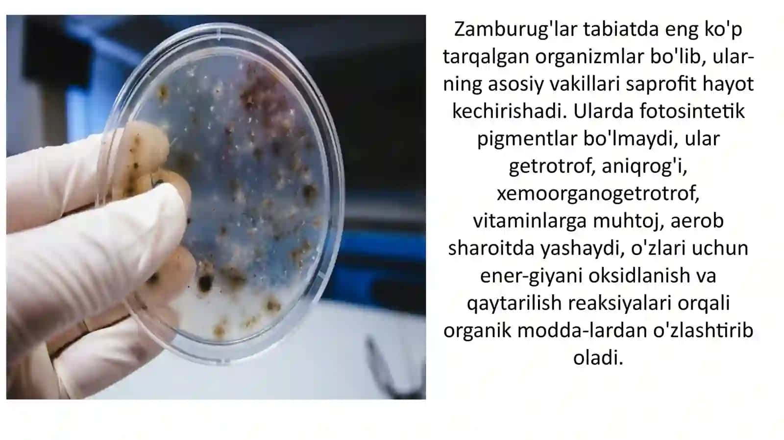 PATOGEN ZAMBRUG’LAR CHIQARUVCHI KASALLIKLAR VA ULARNI LABARATORIYA DIAGNOSTIKASI 4