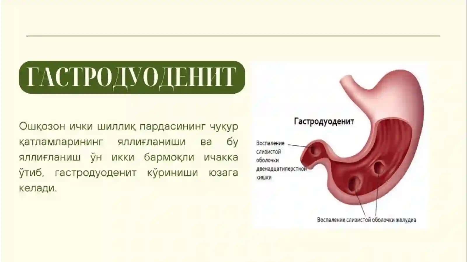 Gastritlar 4