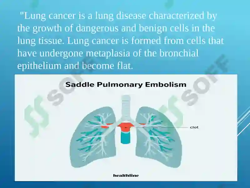 Lungs and a Pulmonary System 4