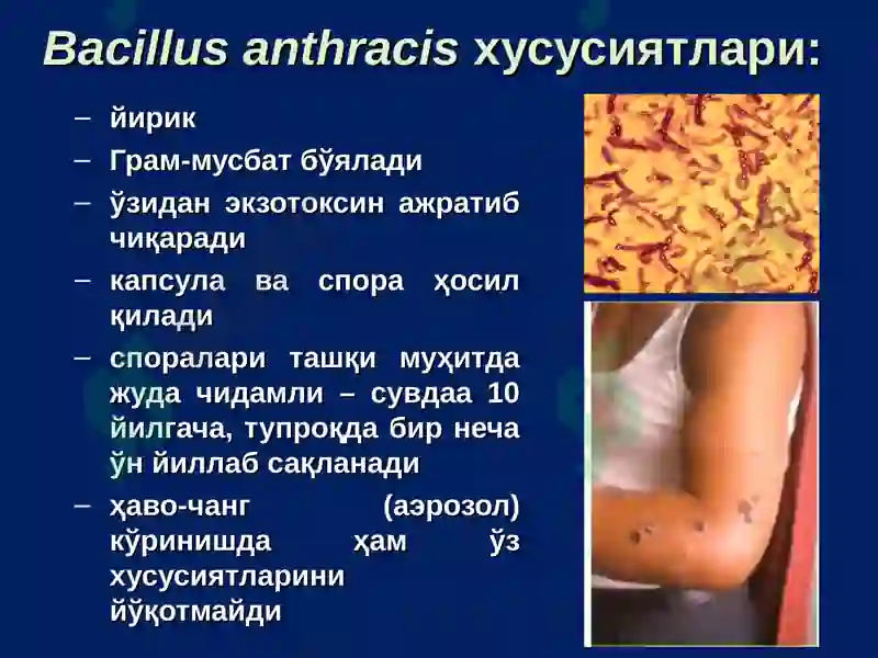 Куйдирги (Bacillus anthracis) 4