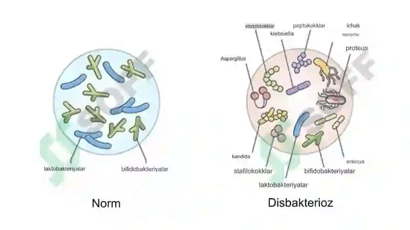 Disbakterioz, disbioz, kelib chiqishida qatnashuvchi omillar. Disbakterioz, disbiozlarga bakteriolog 4