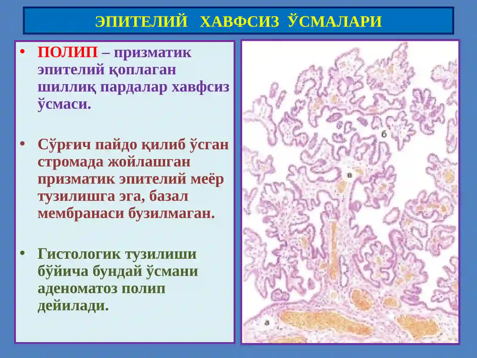 Ўсмалар.Мезенхималўсмалар 4