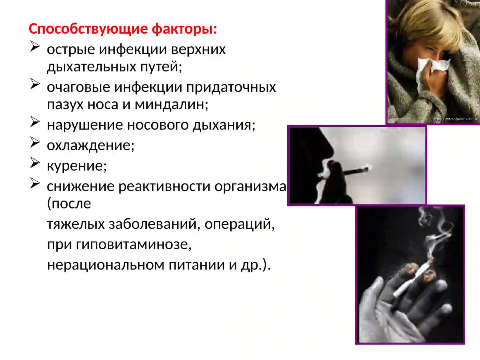 Острый бронхит 4