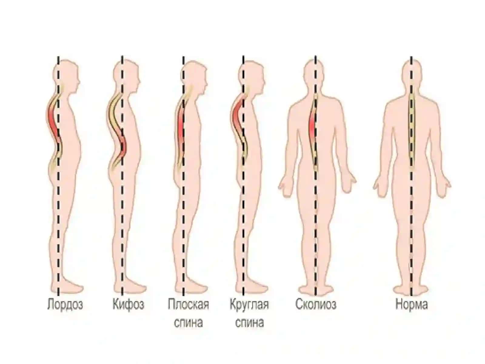 Bolalardaskeletpatologiyasi 4