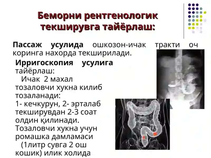 Термиз Иқтисодиёт ва СервисУниверситетиТиббий клиник фанлар кафедраси«Тиббий радиология» фани 5-Маъруза. 4