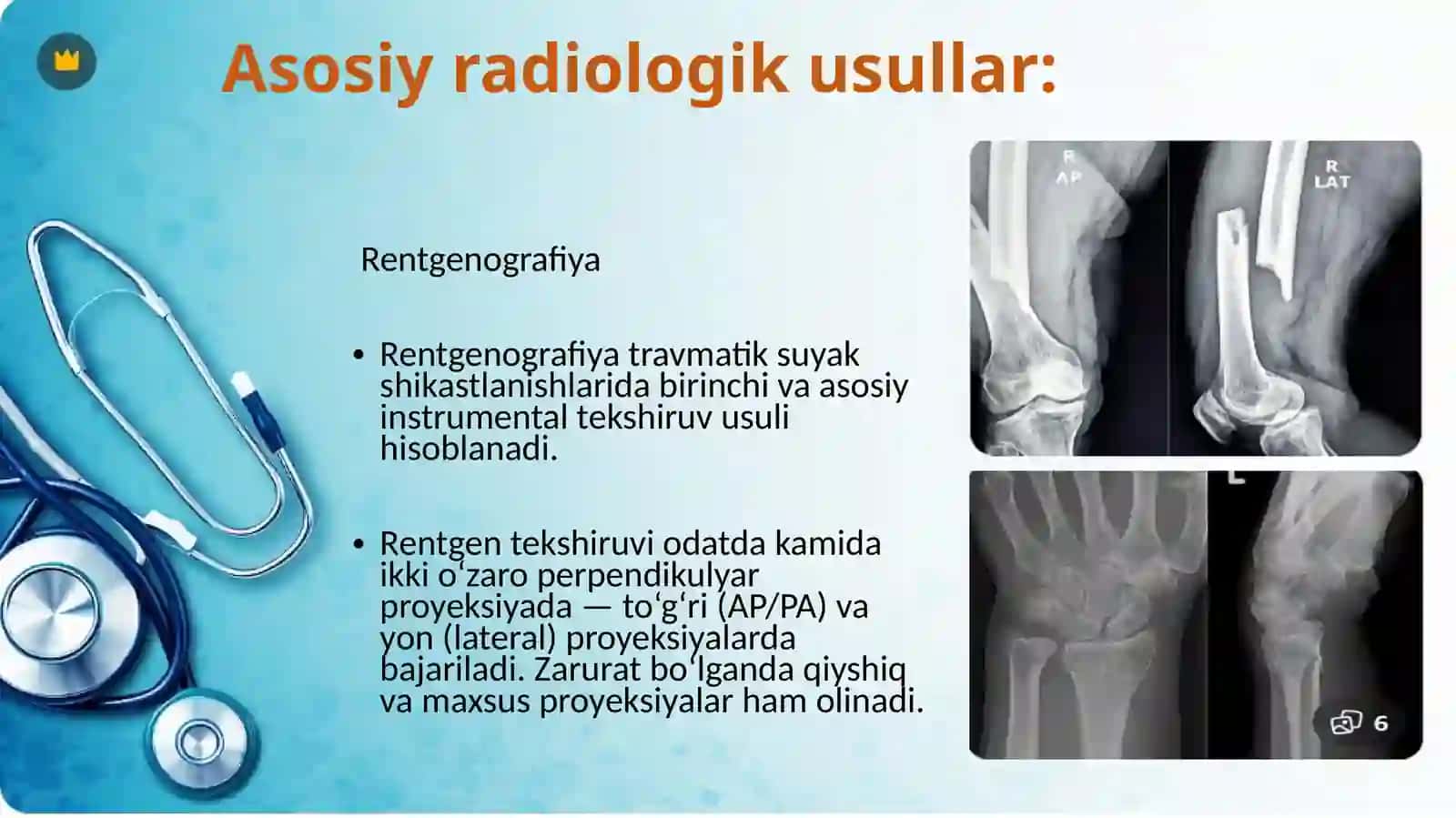 Suyak va bo‘g‘imlarning travmatik shikastlanishi 4