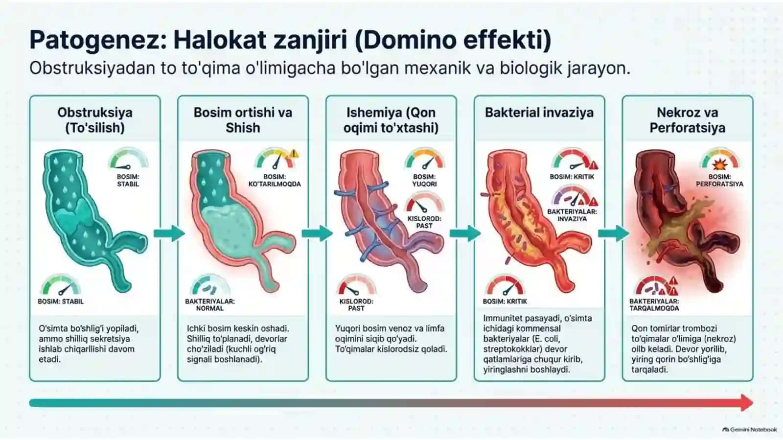 O‘tkir appenditsit — klinika, diagnostika va davolash | 15 slayd 4