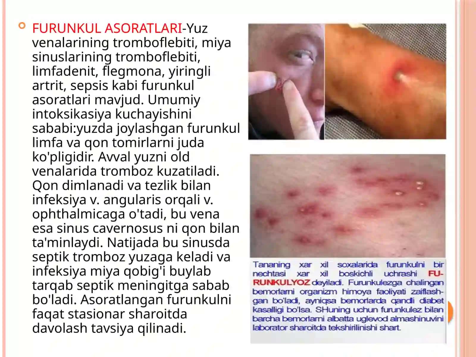 Furunkul 4