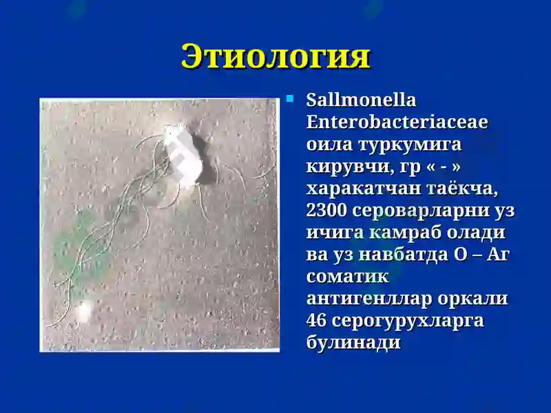 Сальмонеллез 5