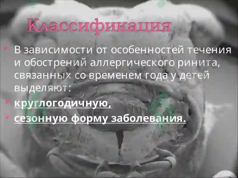 Аллергический ринит 5