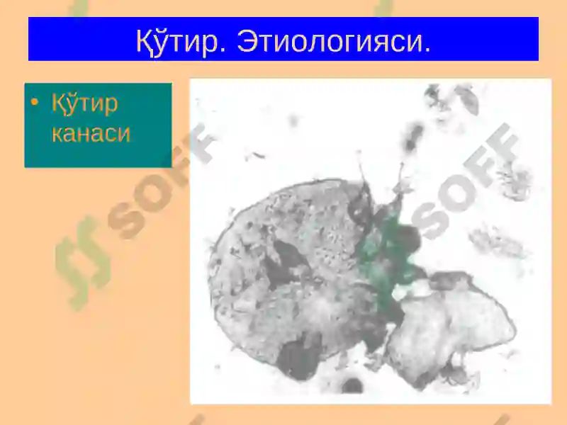 Терининг паразитар касалликлари 5