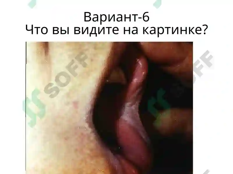Preview 6