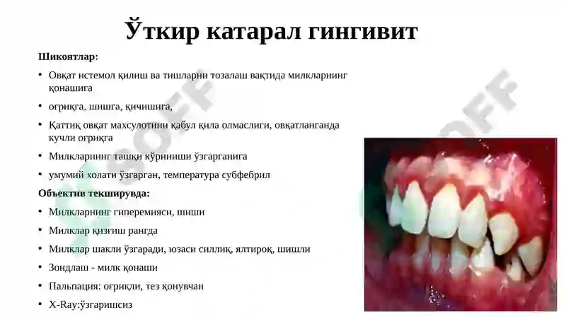 Preview 6