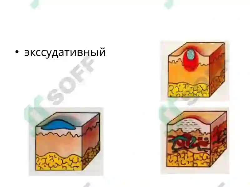 Инфекционные экзантемы 7