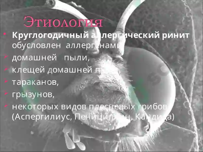 Аллергический ринит 7