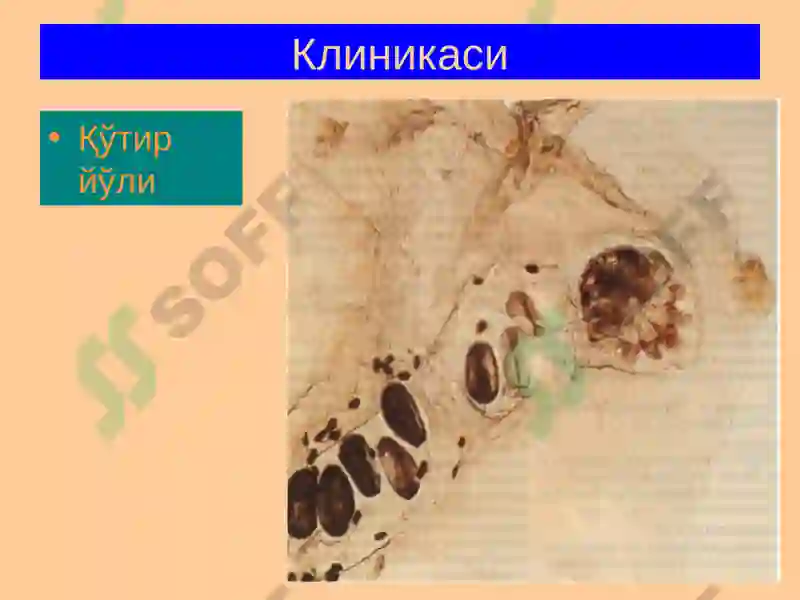 Терининг Паразитар Касалликлари 8