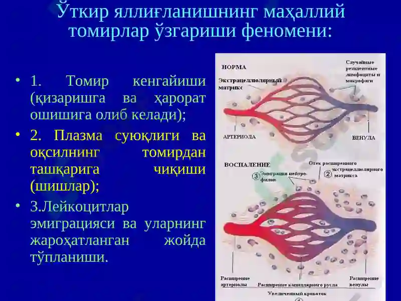 Яллиғланиш -INFLAMMATION 8