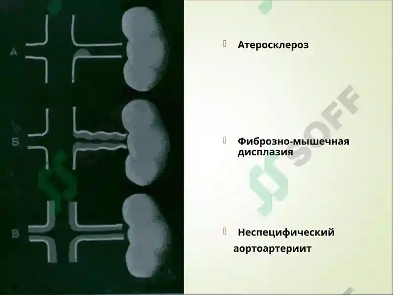 Preview 8
