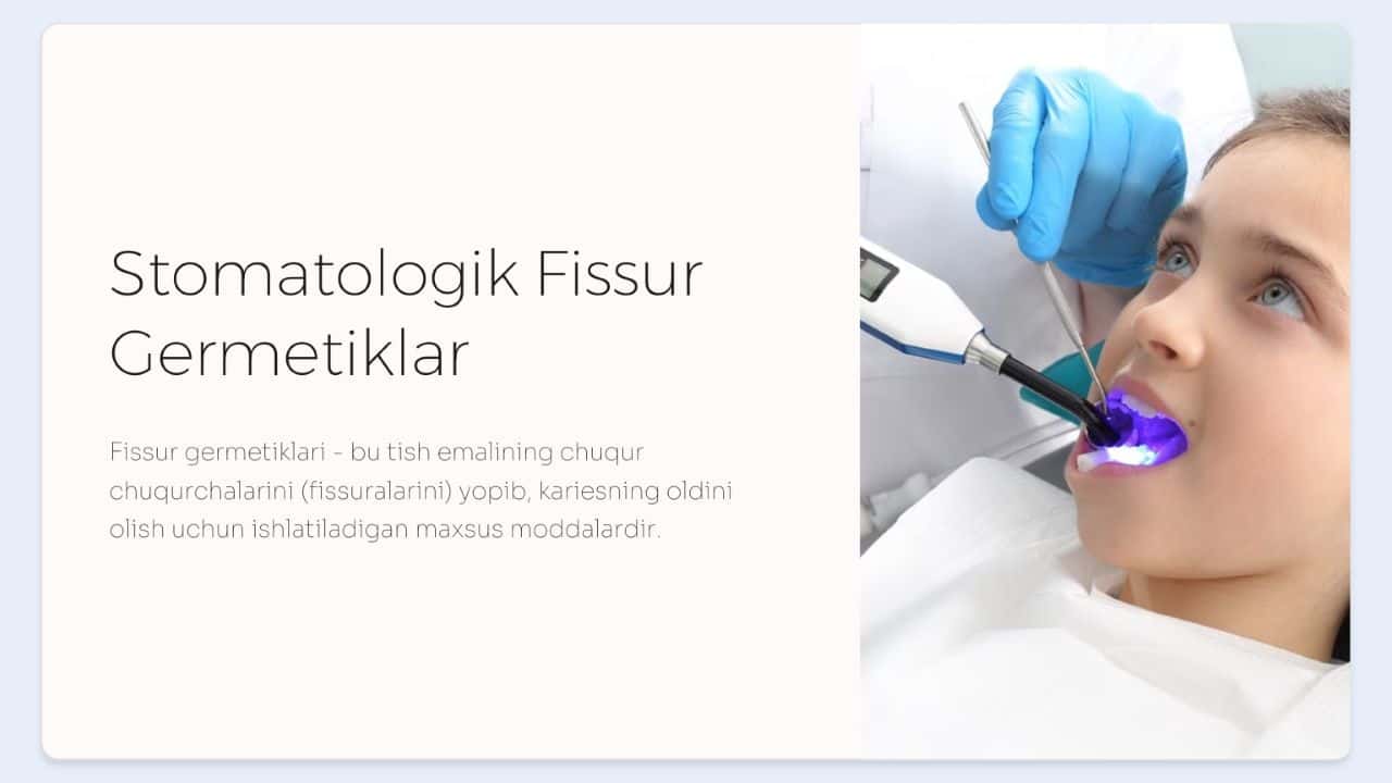 Fissur germetiklar.  Qo‘llash texnikasi.