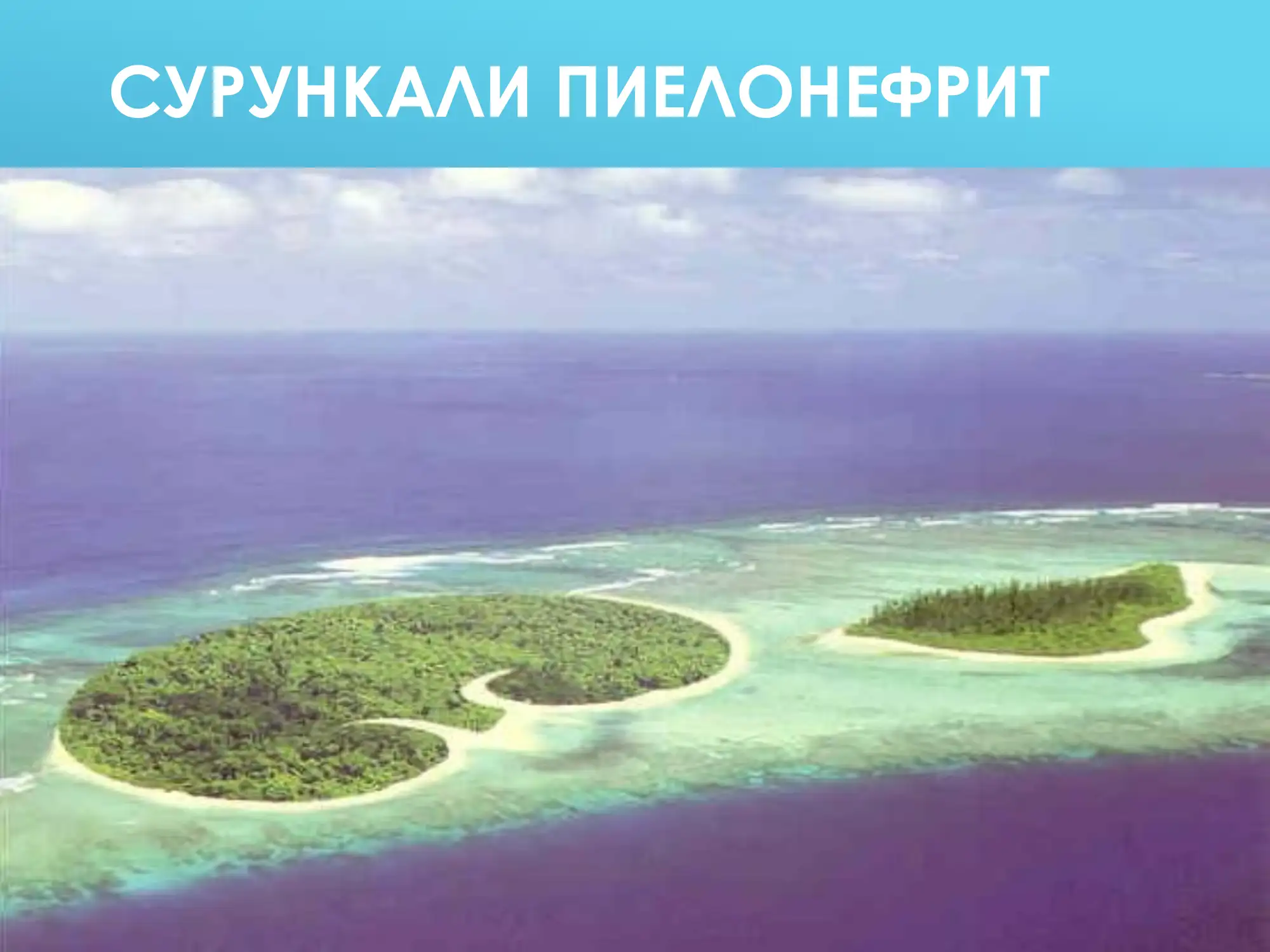 СУРУНКАЛИ ПИЕЛОНЕФРИТ