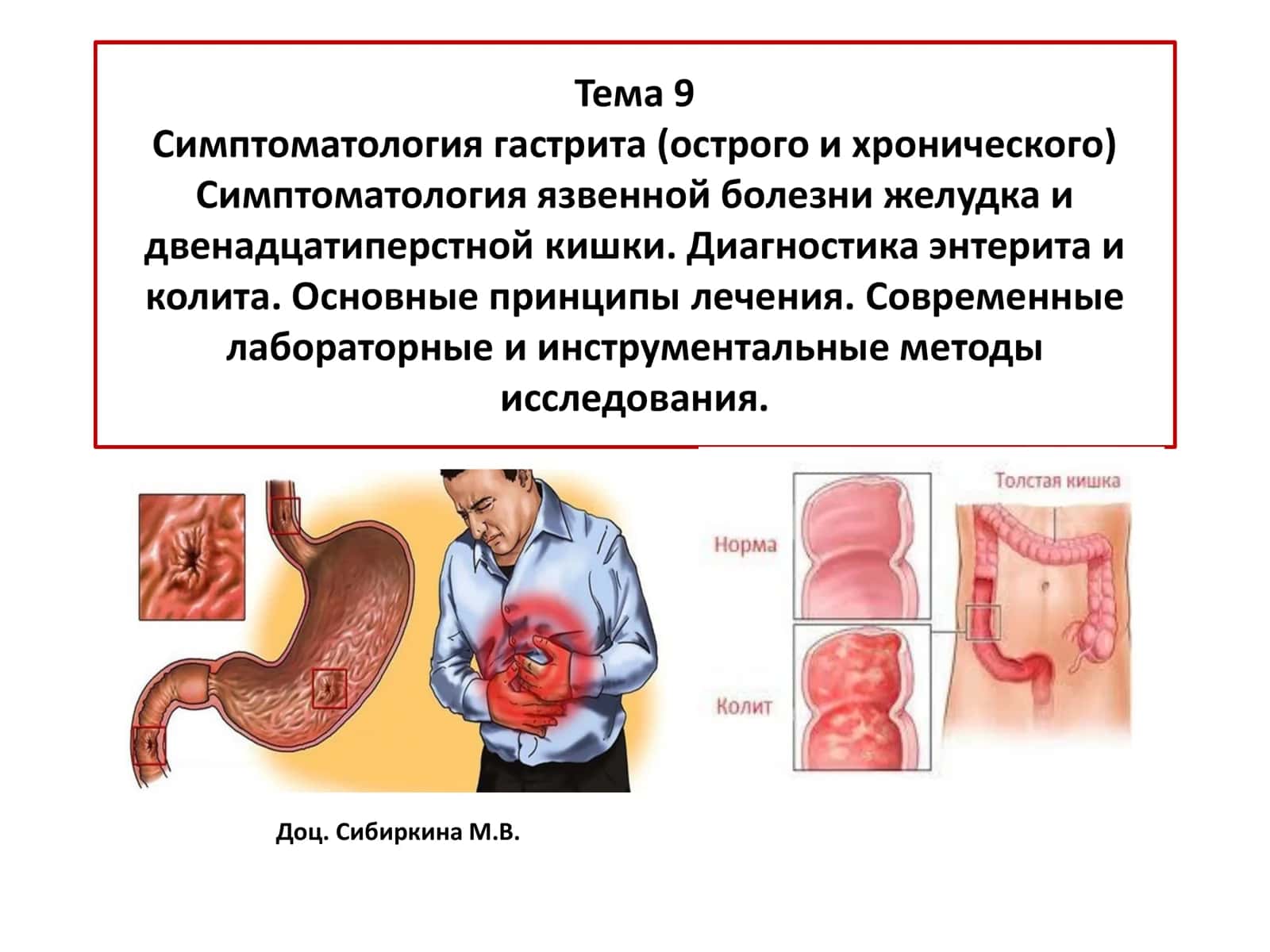 Гастрит