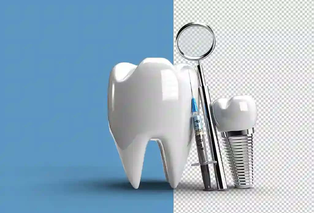 Tish implantlari jarrohlik kontseptsiyasi 3D ko'rsatuvchi shaffof PSD fayli | Dental implants surgery concept 3d rendering transparent psd file