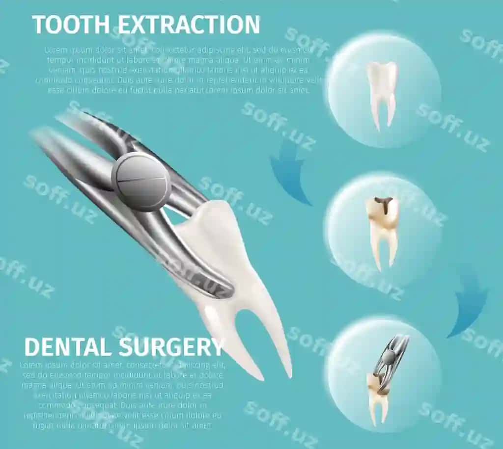 Realistik illustratsiya infografika tish jarrohlik | Realistic illustration infographic dental surgery