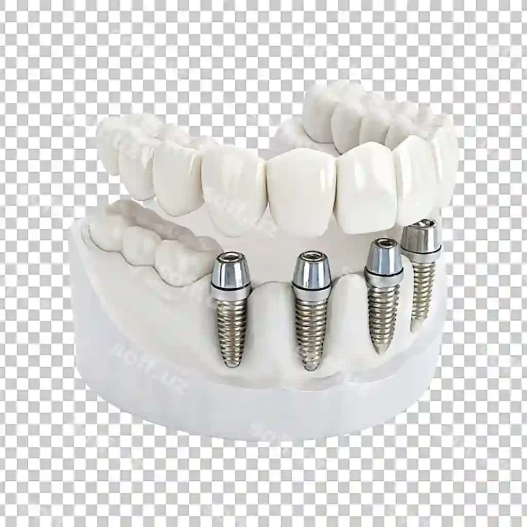 3d render oq tish implant tish qo'shiq ikonlar to'plami yaxshi ko'rinish ajraltirilgan | 3d render white tooth implant denture icon set closeup isolated
