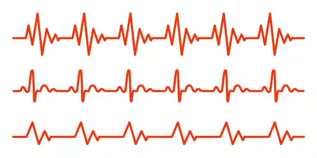 Qizil yurak urishi piktogrammalarining tekis dizayndagi vektor tasviri elektrokardiogramma belgisi | Red heartbeat icons flat design vector illustration sign electrocardiogram