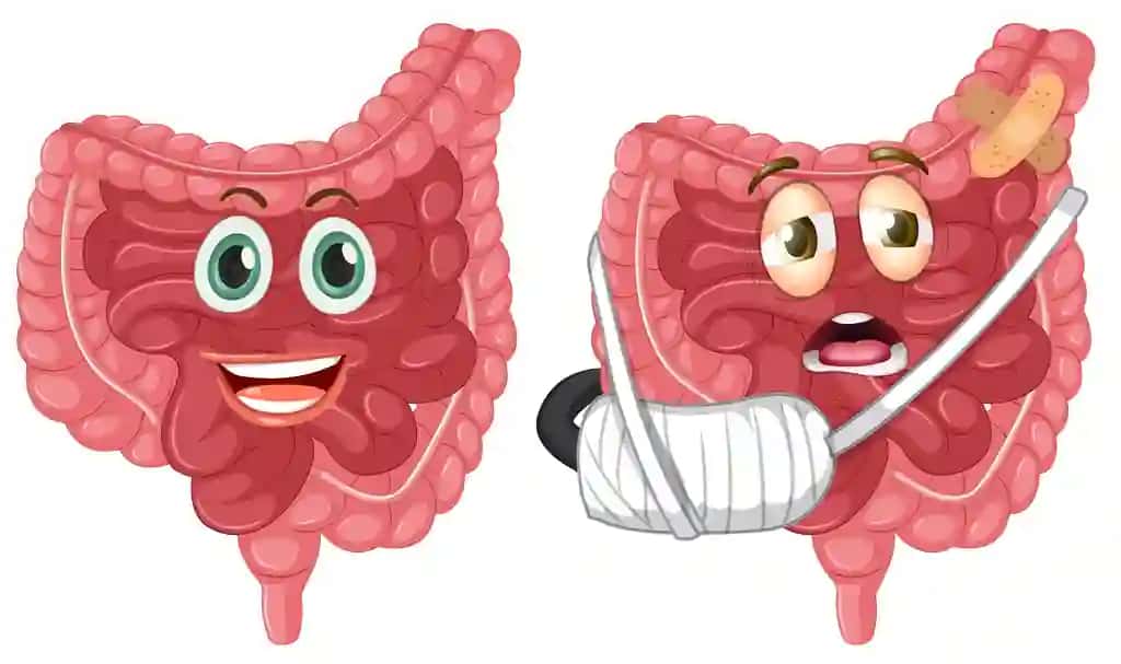 Sog'lom shikastlangan ichakni o'rnating | Set healthy injured intestine
