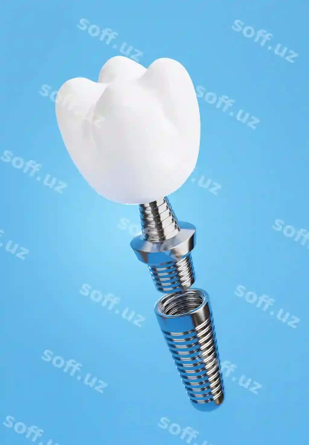 3d render tish implantatsiyasi assemlеyasi ko‘kok fonda | 3d render dental implant assembly blue background
