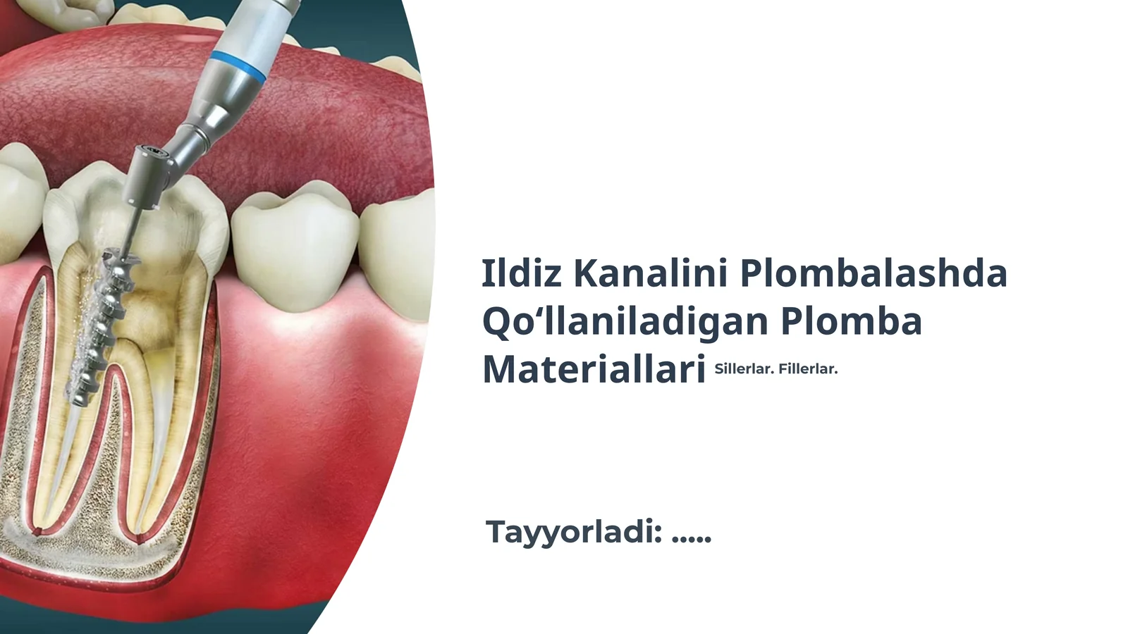 Ildiz Kanalini Plombalashda Qo‘llaniladigan Plomba Materiallari